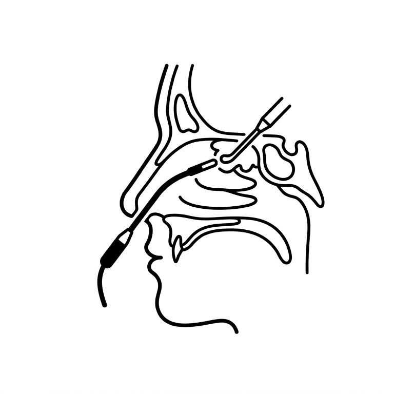 FESS — Functional Sinus Surgery